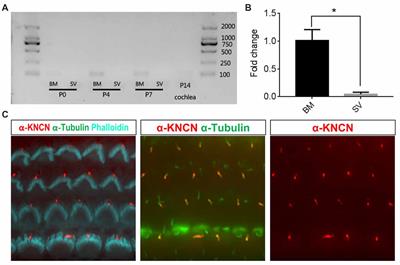 Deletion of Kncn Does Not Affect Kinocilium and Stereocilia Bundle Morphogenesis and Mechanotransduction in Cochlear Hair Cells